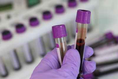 Can Antibody Tests Tell Us Who Is Immune to COVID-19?
