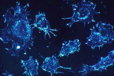 Cancer-Fighting Viruses Point Way to Better Treatment, U of G Study Finds