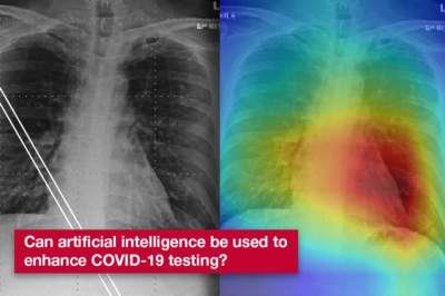 U of G Researchers Use AI for Rapid Bedside COVID-19 Diagnosis