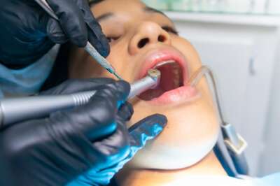 Proposed Dental Care Program Beneficial Despite Costs, Says U of G Historian