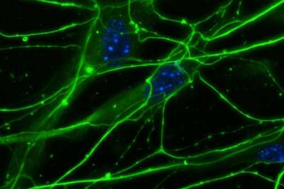 U of G Researcher Receives Funding for Regenerative Medicine Research 