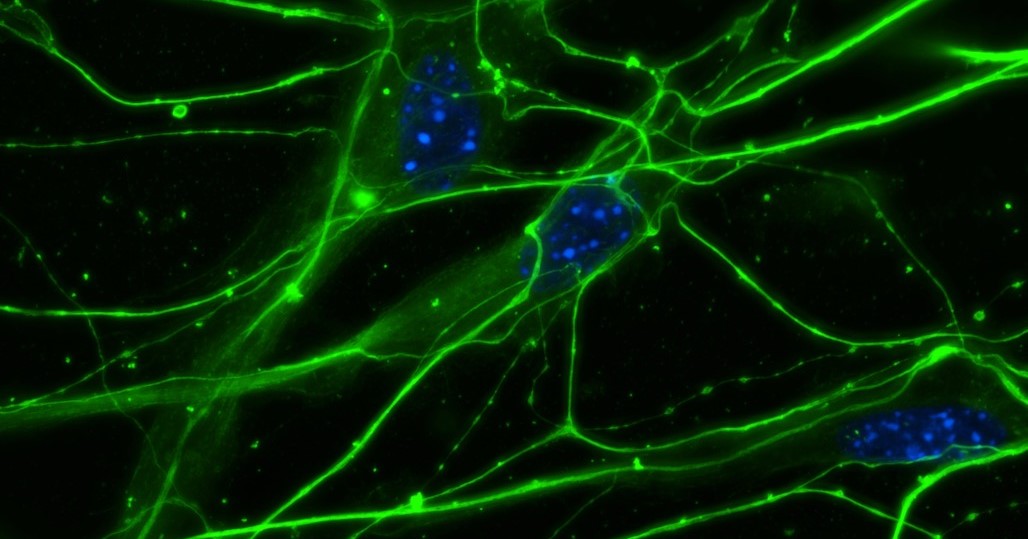 An artist rendering of neurons