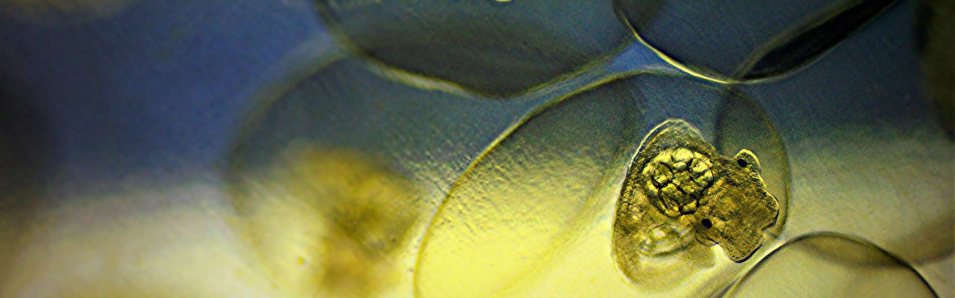 A closeup photon of several snail embryos