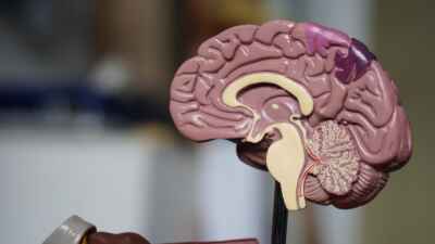 U of G Researchers Use ‘Mini-Brains’ in Search for Novel Cancer Treatment  