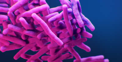 U of G, SickKids Discovery May Help Target TB Bacteria ‘Dimmer Switch’  