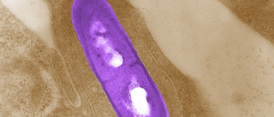 Expert Available: Listeria Outbreaks 